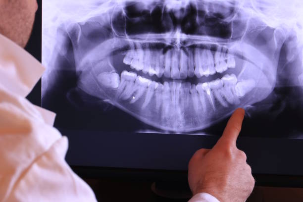 Best Orthodontic Emergency Dentist in Los Altos, CA