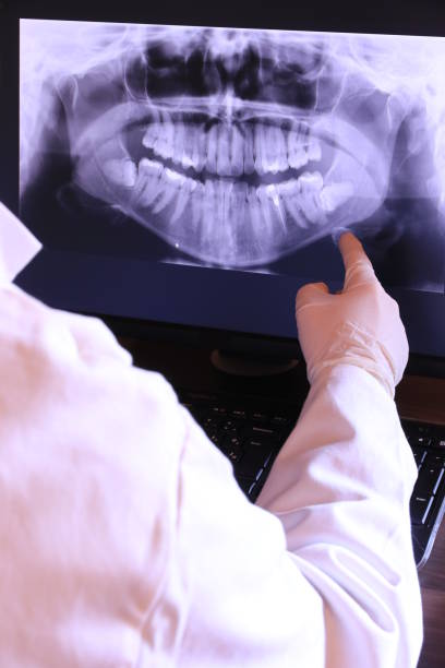 Best Emergency Dentist for Special Needs Patients in Los Altos, CA